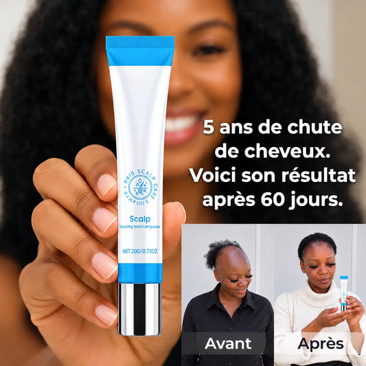 Scalp Hair Ampoule – La solution idéale pour des cheveux épais et magnifiques
